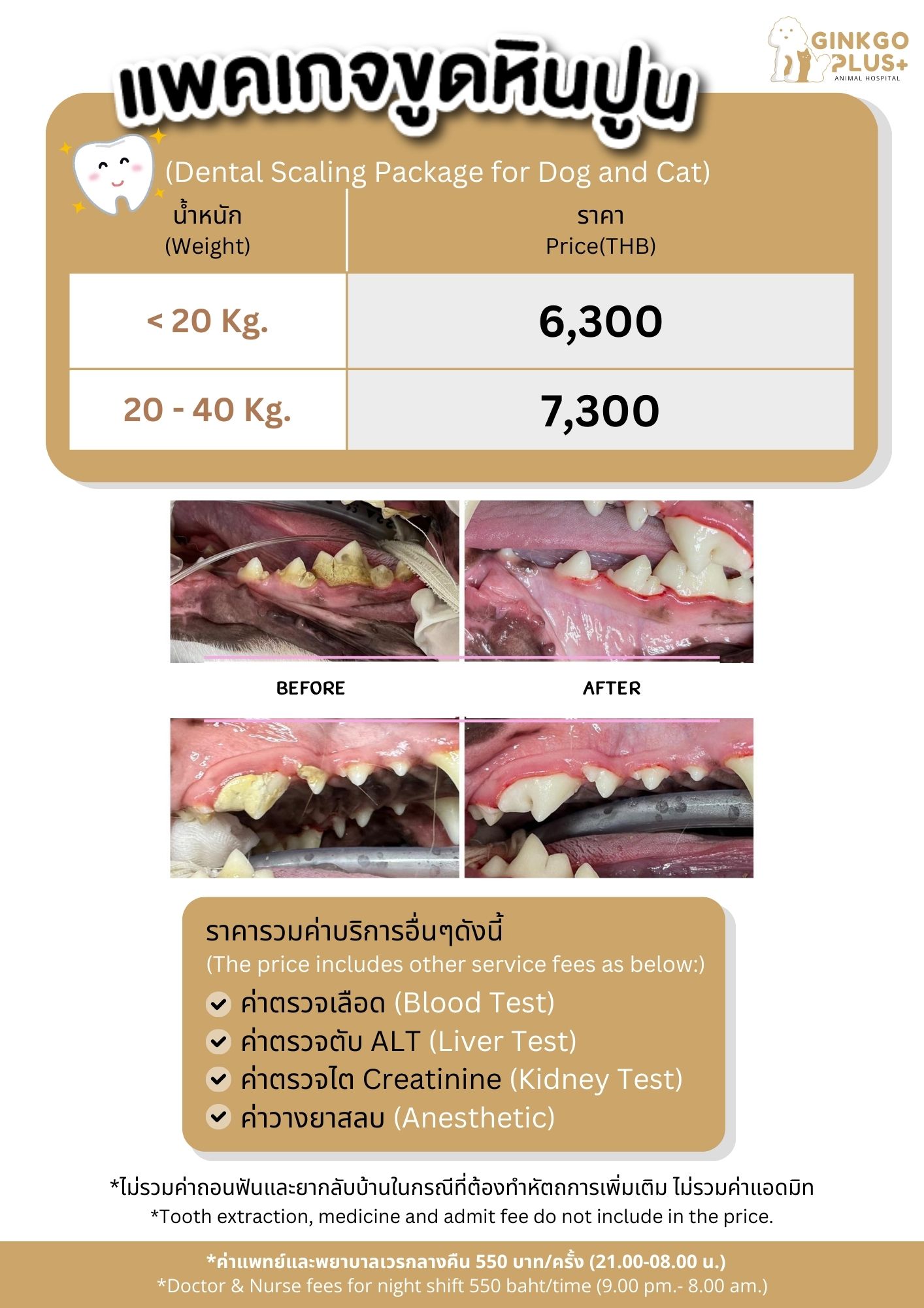 แพ็คเกจขูดหินปูน